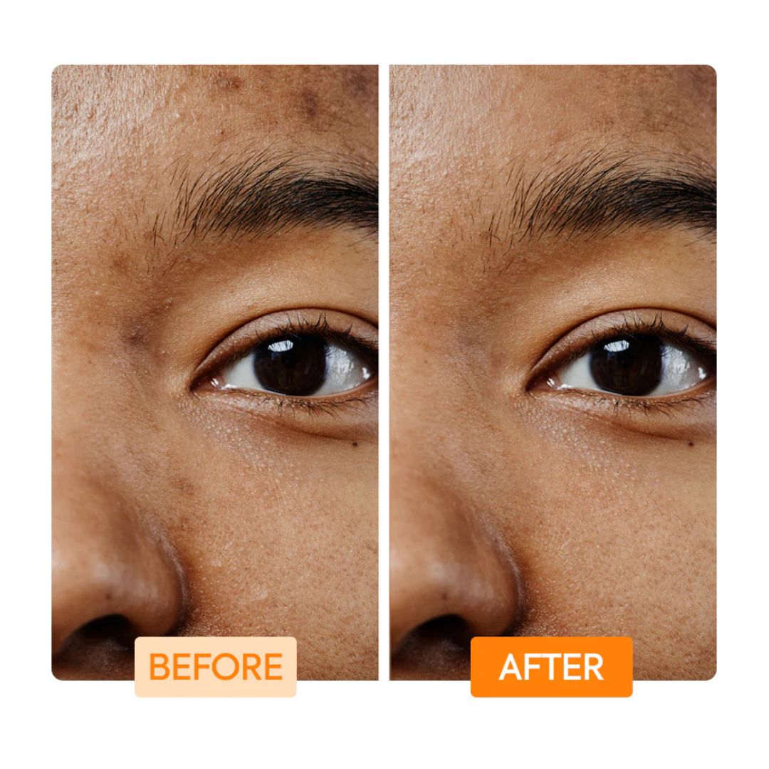 Makari IYKYK Vitamin C and Turmeric Facial Cleansing Bar