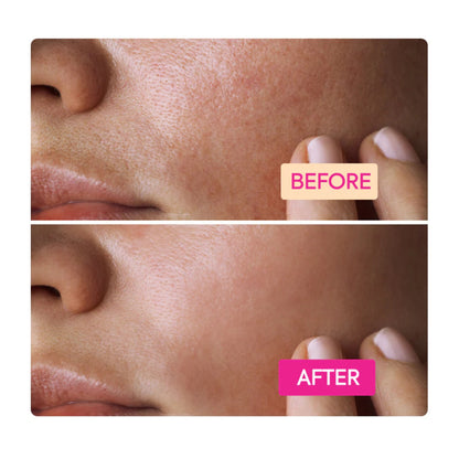 Makari IYKYK Niacinamide Facial Cleansing Bar 100mg