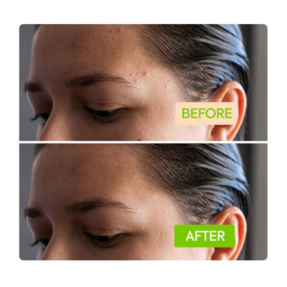 Makari IYKYK Ginger Cleansing Bar 100mg